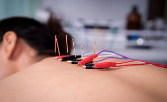 Electroacupuntura, Electrolipolisis, Electroantiarrugas, en centro de formación en salud integrativa ISMET Barcelona