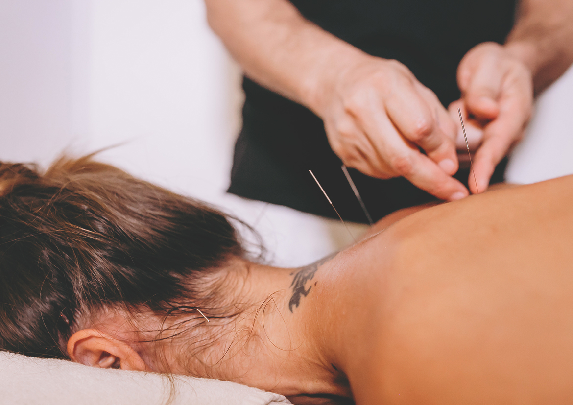 Prácticas con pacientes reales de Acupuntura – MTC