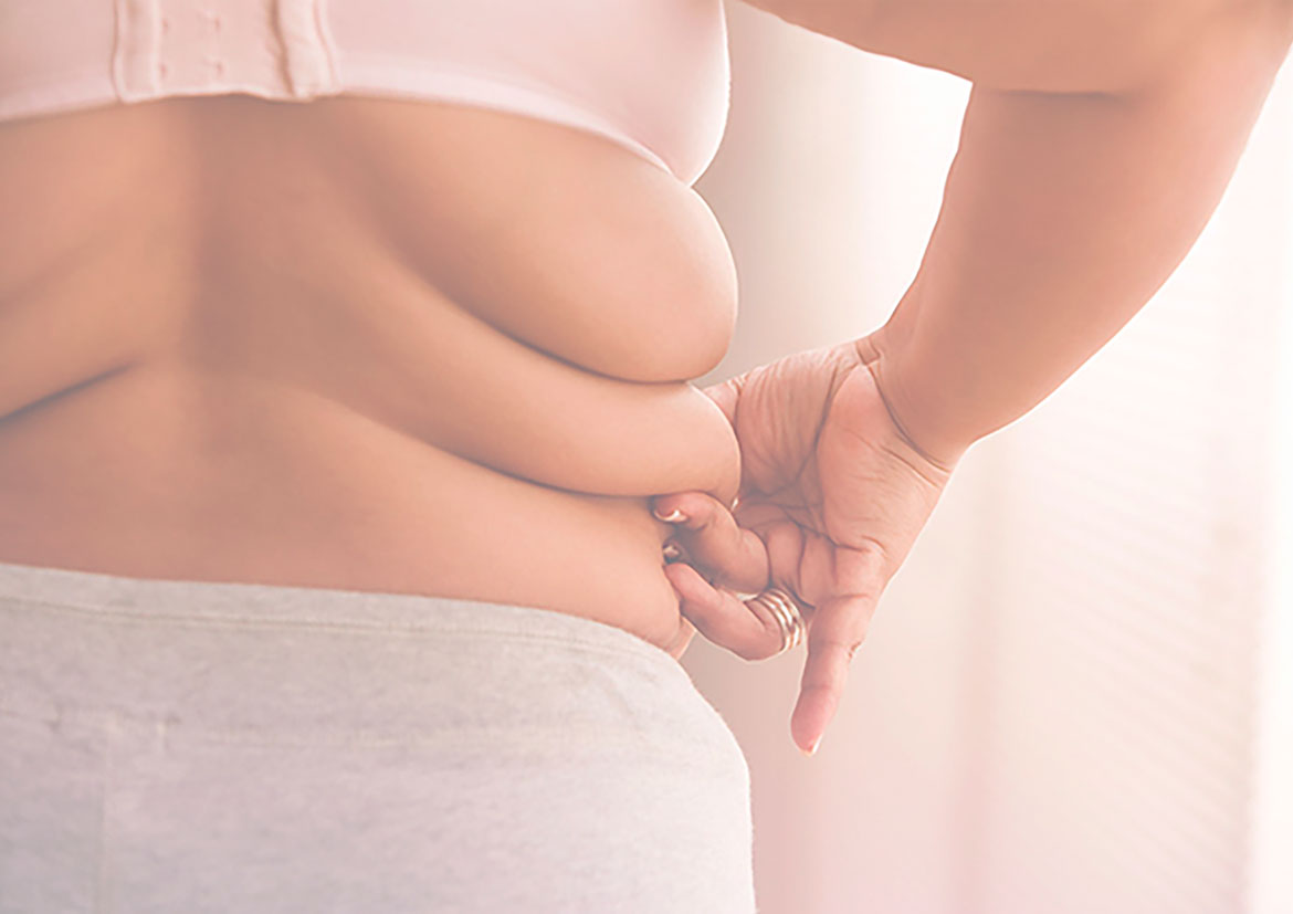 Nutrición suplementación en sobrepeso, obesidad y síndrome metabólico