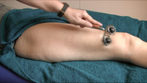 Anticelulítico de piernas y glúteos con chanbeauté, la estética terapéutica, en centro de formación en salud integrativa ISMET Barcelona