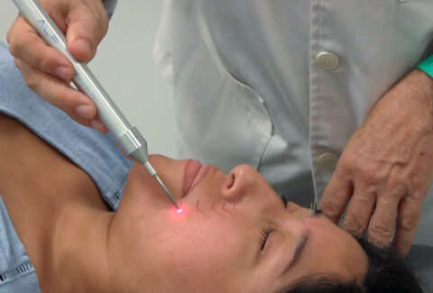 Lifting facial: Acupuntura, electropuntura y laserpuntura, en centro de formación ISMET Barcelona
