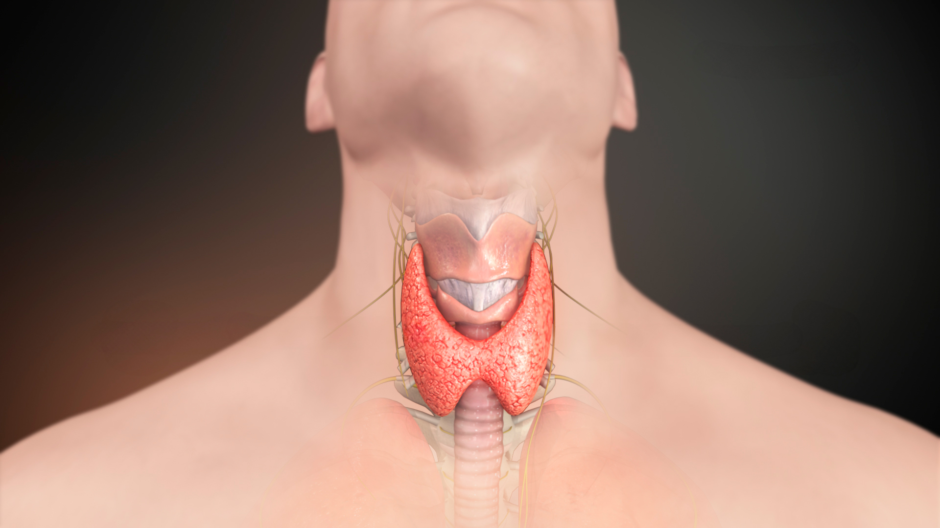 Webinar gratuito Autoinmunidad y tiroiditis de hashimoto en ISMET Barcelona